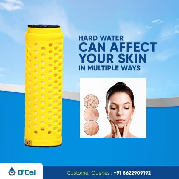 hard water can affect your skin